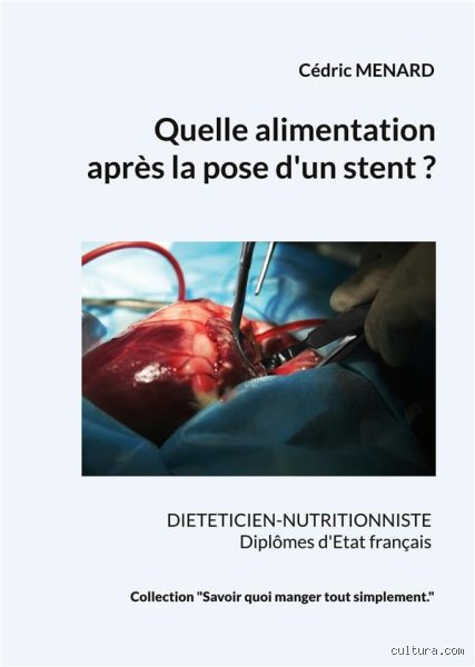 Quels sont les aliments recommandés après la pose d'un stent cardiaque pour éviter de boucher vos artères à nouveau ?