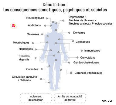 Quels sont les signes qu'on ne mange pas assez ?