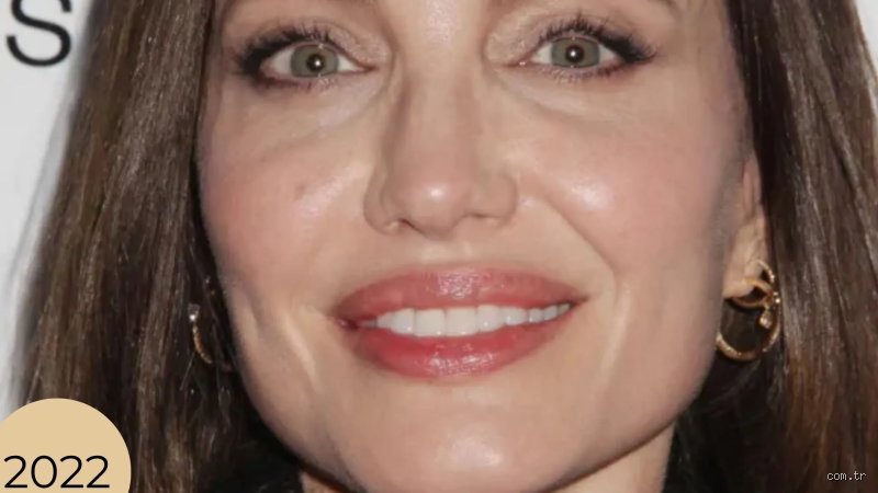 Pourquoi les dents d'Angelina Jolie sont-elles si particulières et comment ont-elles redéfini les standards esthétiques mondiaux ?
