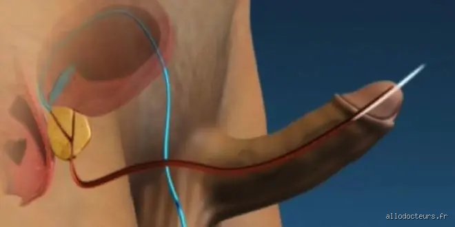 Comment faire pour que l'éjaculation ne se produise pas au bout de 30 secondes et durer plus longtemps ?