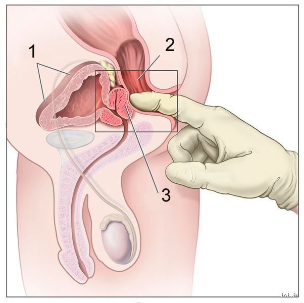 Comment puis-je stimuler la prostate de mon conjoint : le guide complet pour explorer ce plaisir tabou en toute complicité