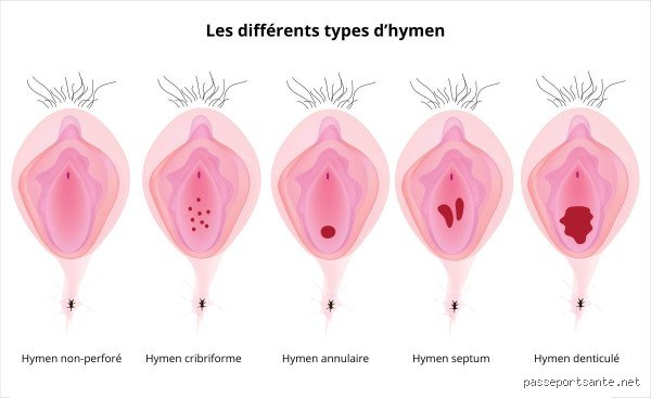 Comment rendre la première fois moins douloureuse et aborder sa sexualité avec sérénité et confort