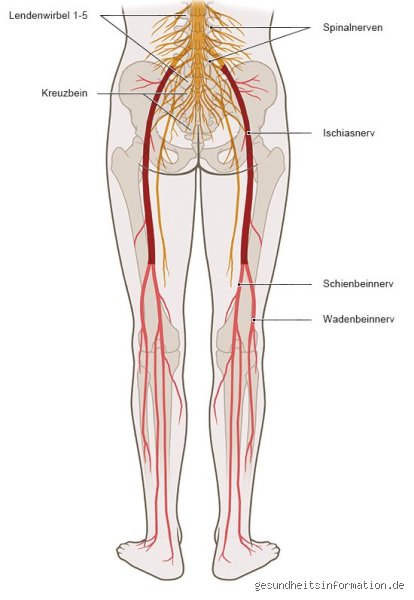 Welcher Nerv strahlt ins Bein? Ursachen, Anatomie und Diagnose (Teil 1)