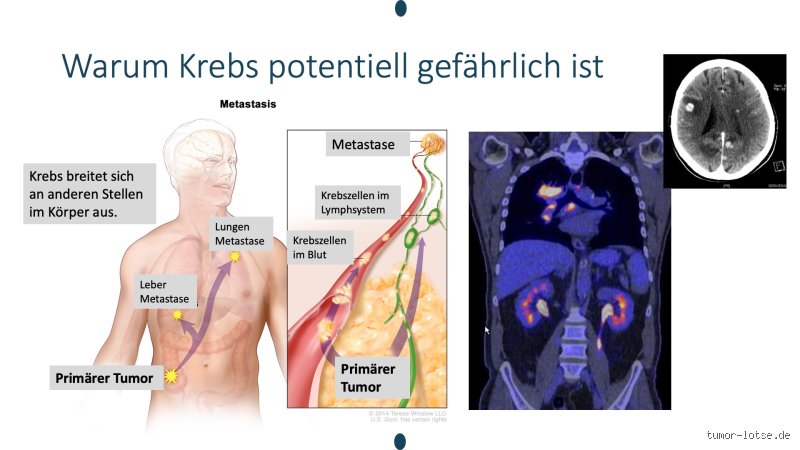 Wie sterben Krebszellen ab?