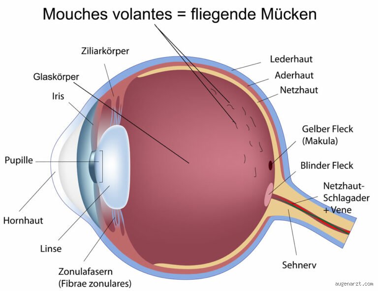 Kann der Augenarzt Mouches volantes sehen?