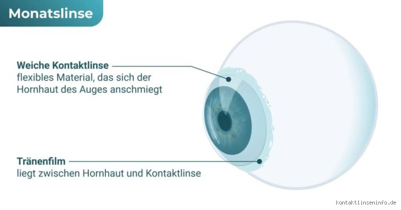 Monatslinsen versus Jahreslinsen: Der große Vergleich für klare Sicht und gesunde Augen