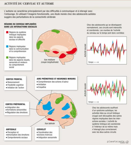 Neurosciences et idées reçues : qu'est-ce qui se passe dans le cerveau d'un autiste au quotidien ?