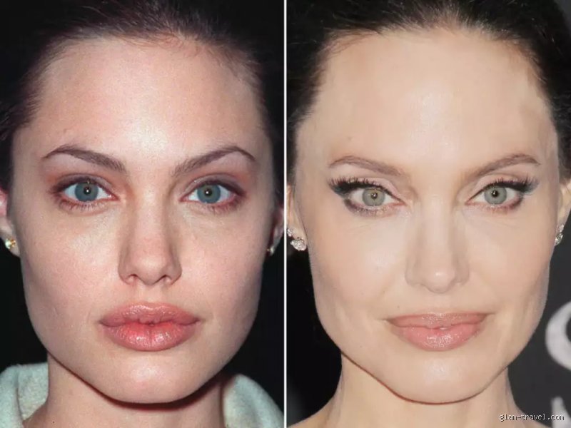 Angelina Jolie a-t-elle eu recours à la chirurgie esthétique des lèvres ou est-ce un pur fantasme collectif ?