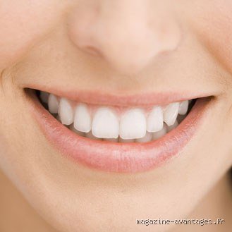 C'est quoi des belles dents ? La vérité derrière le mythe du sourire parfait et ultra-blanc