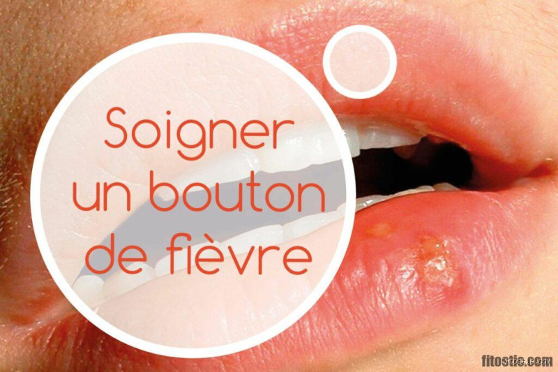 Comment faire partir des boutons en 5 minutes ?