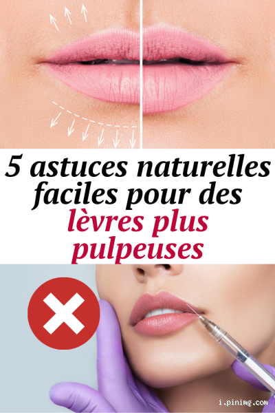Comment soigner mes lèvres ? 5 astuces simples et efficaces !