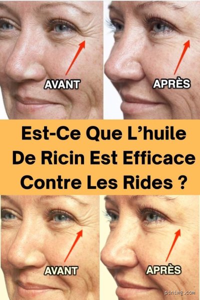 Est-ce que l'huile de ricin est bonne pour les rides du visage et faut-il vraiment l'adopter ?