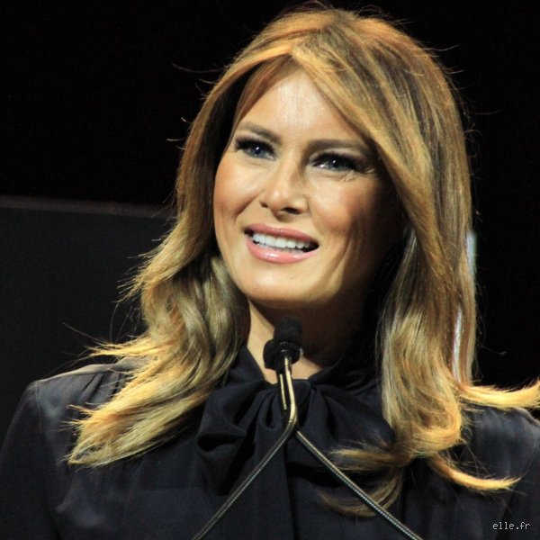Melania Trump a-t-elle eu recours à la chirurgie esthétique ? Analyse sans filtre de l’évolution faciale de l’ex-First Lady