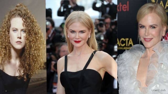 Pourquoi Nicole Kidman n'a pas de rides ? Le secret entre génétique de fer et médecine esthétique millimétrée