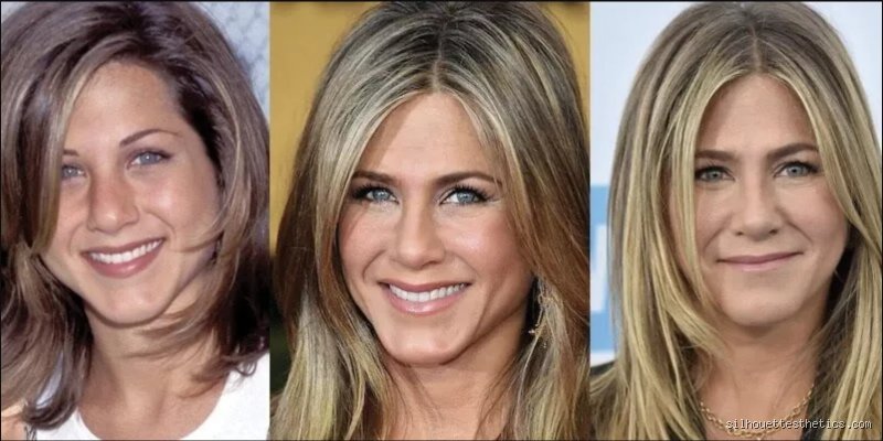 Qu'est-ce qui est différent au niveau de la bouche de Jennifer Aniston ? Le décryptage sans tabou d'un sourire iconique