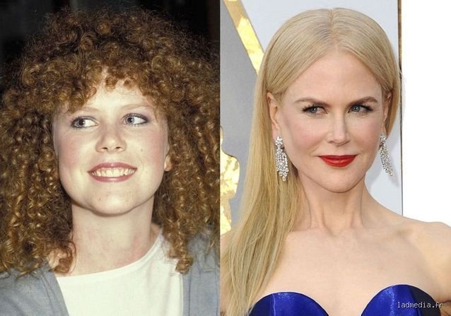 Qu'est-il arrivé à la beauté de Nicole Kidman ? Anatomie d'une métamorphose entre Hollywood et médecine esthétique