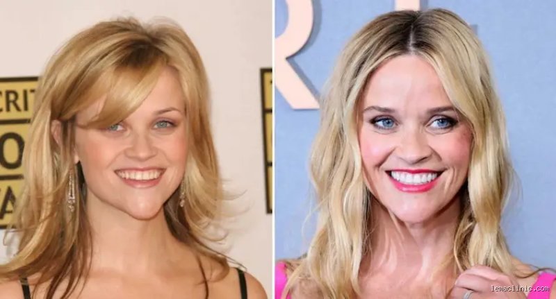 Qu'est-il arrivé aux dents de Reese Witherspoon ? Le mystère d'un sourire hollywoodien qui défie le temps et les tendances