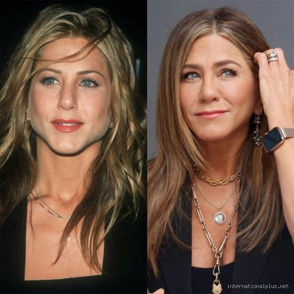 What has Jennifer Aniston done to her lips? Analyse d’une métamorphose subtile qui enflamme les réseaux sociaux