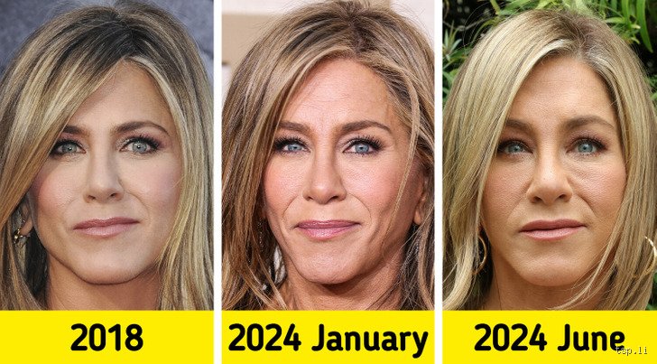 What’s going on with Jennifer Aniston’s mouth? Entre rumeurs de chirurgie et réalité du vieillissement hollywoodien