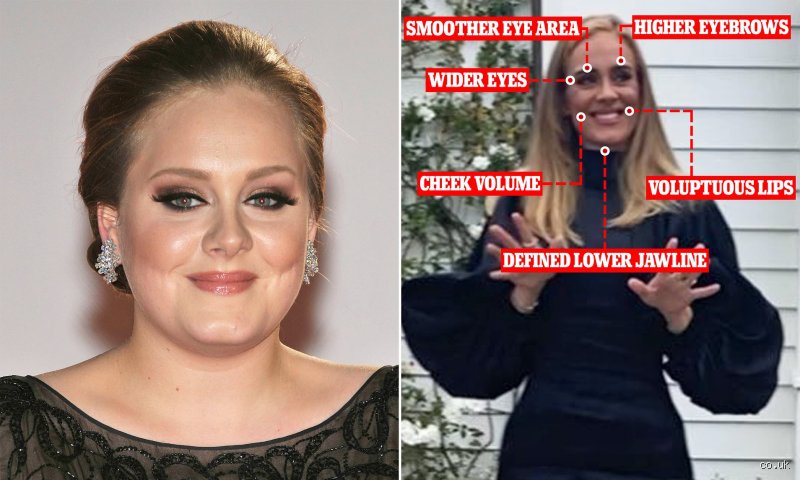 Why does Adele look so different?