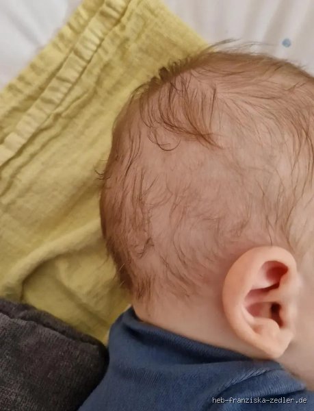 Bis wann verwächst sich flacher Hinterkopf?