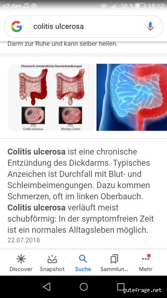 Was tun bei einem Colitis Schub?
