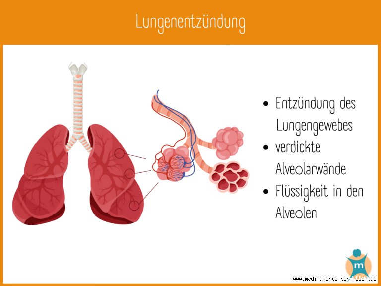Atemnot & Panik? So fühlt sich eine verklebte Lunge WIRKLICH an!