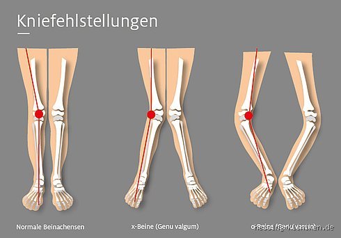 Wie kommt man wieder auf die Beine, wenn man verlassen wird? Der Weg zurück zu sich selbst