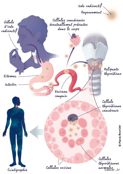 Introduction et fondements biochimiques de l'iode 131 dans la physiologie thyroïdienne