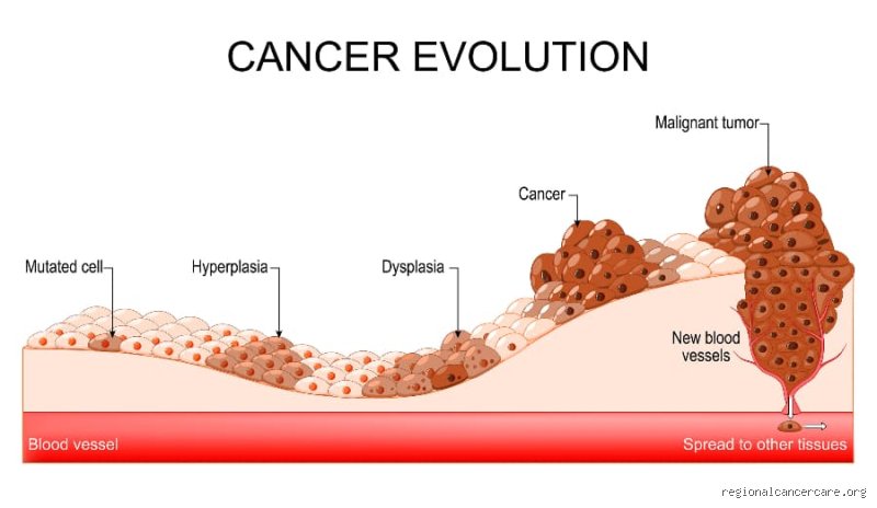 Quel est le cancer à évolution la plus lente ? Enquête au cœur de ces tumeurs indolentes qui bousculent la médecine
