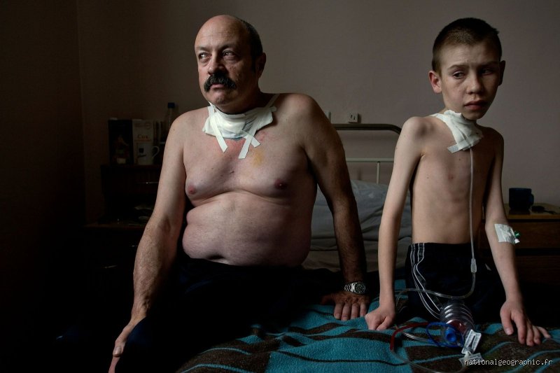 Est-ce qu'il y a des survivants de Tchernobyl ? La vérité complexe sur ceux qui ont défié l'atome