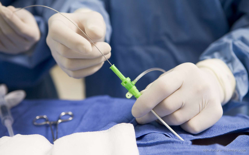 Quel bras pour une coronarographie ? Découvrez l'importance du choix