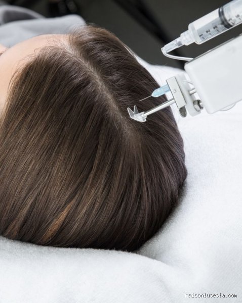 Comment cacher un trou dans les cheveux ?