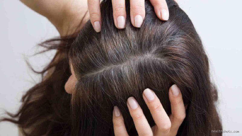 Comment stopper le grisonnement prématuré des cheveux ?