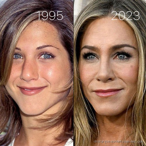 Qu'est-il arrivé à Jennifer Aniston quand elle avait 9 ans ? Le traumatisme méconnu derrière le sourire de la star