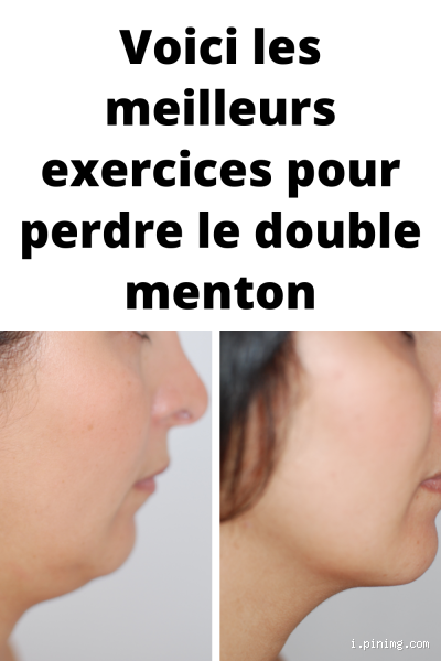 Comment perdre la graisse du menton ? Astuces et solutions efficaces