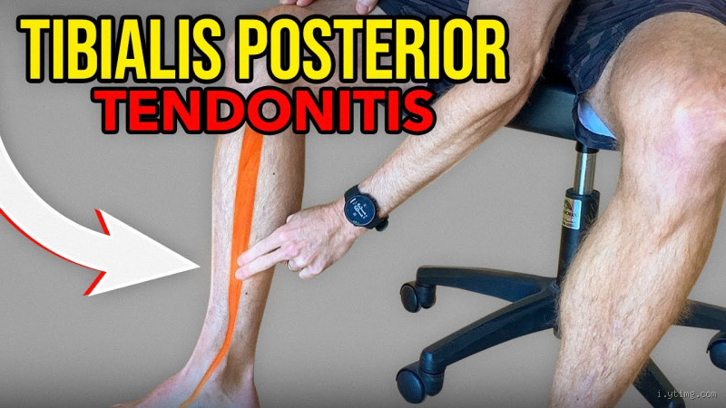 Comment régénérer ses tendons ? Les solutions qui fonctionnent vraiment