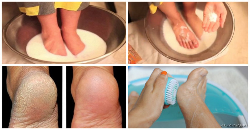 Comment se faire craquer les pieds ?