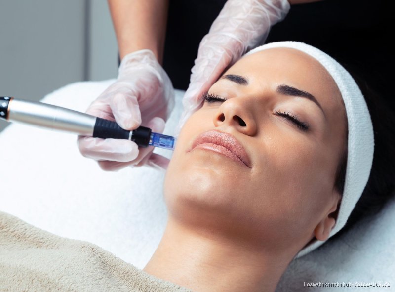 Ist Microneedling gegen Falten?