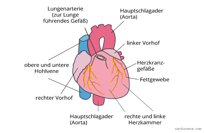 Auf welcher Seite liegen bei Herzinsuffizienz?