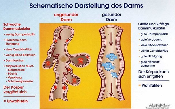 Hat der Darm Einfluss auf den Blutdruck?