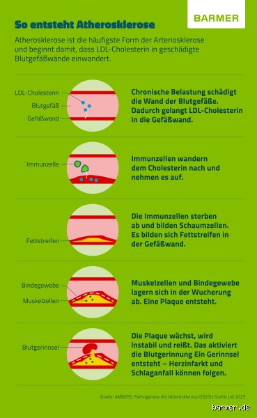 Hat jeder im Alter Arteriosklerose? Warum unsere Gefäße nicht zwangsläufig verkalken müssen