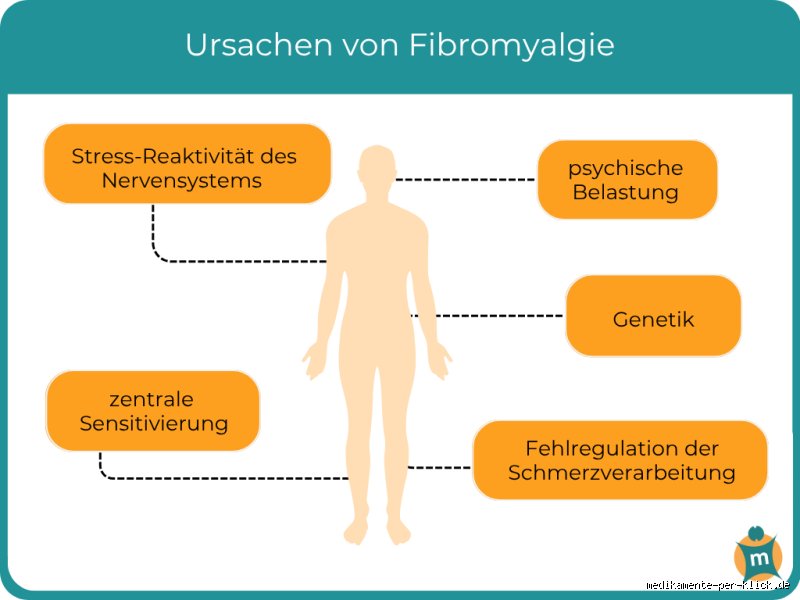 Hat man bei Fibromyalgie starke Schmerzen? Ursachen, Symptome und Realität
