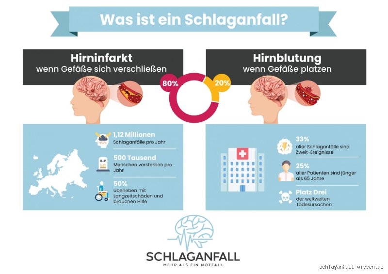 Hirninfarkt und Schlaganfall: Ist das wirklich dasselbe?