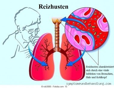 Ist frische Luft bei Reizhusten gut?