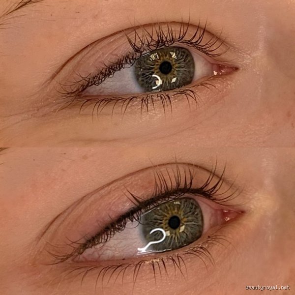 Ist Wimpernkranzverdichtung gefährlich? Risiken, Technik und Experten-Check