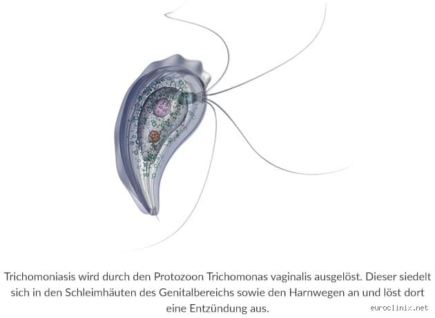 Kann eine Frau Trichomoniasis auf einen Mann übertragen? Alles, was du wissen musst