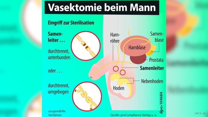 Kann man als Sterilisierter Mann noch kommen?