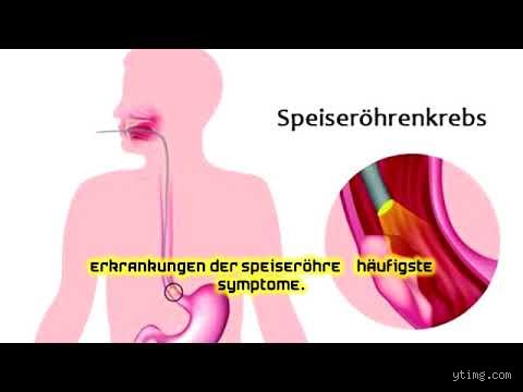 Kann man Ersticken wenn etwas in der Speiseröhre steckt?