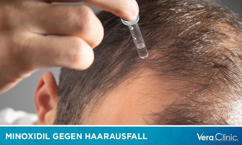 Kann Minoxidil Haarausfall rückgängig machen?